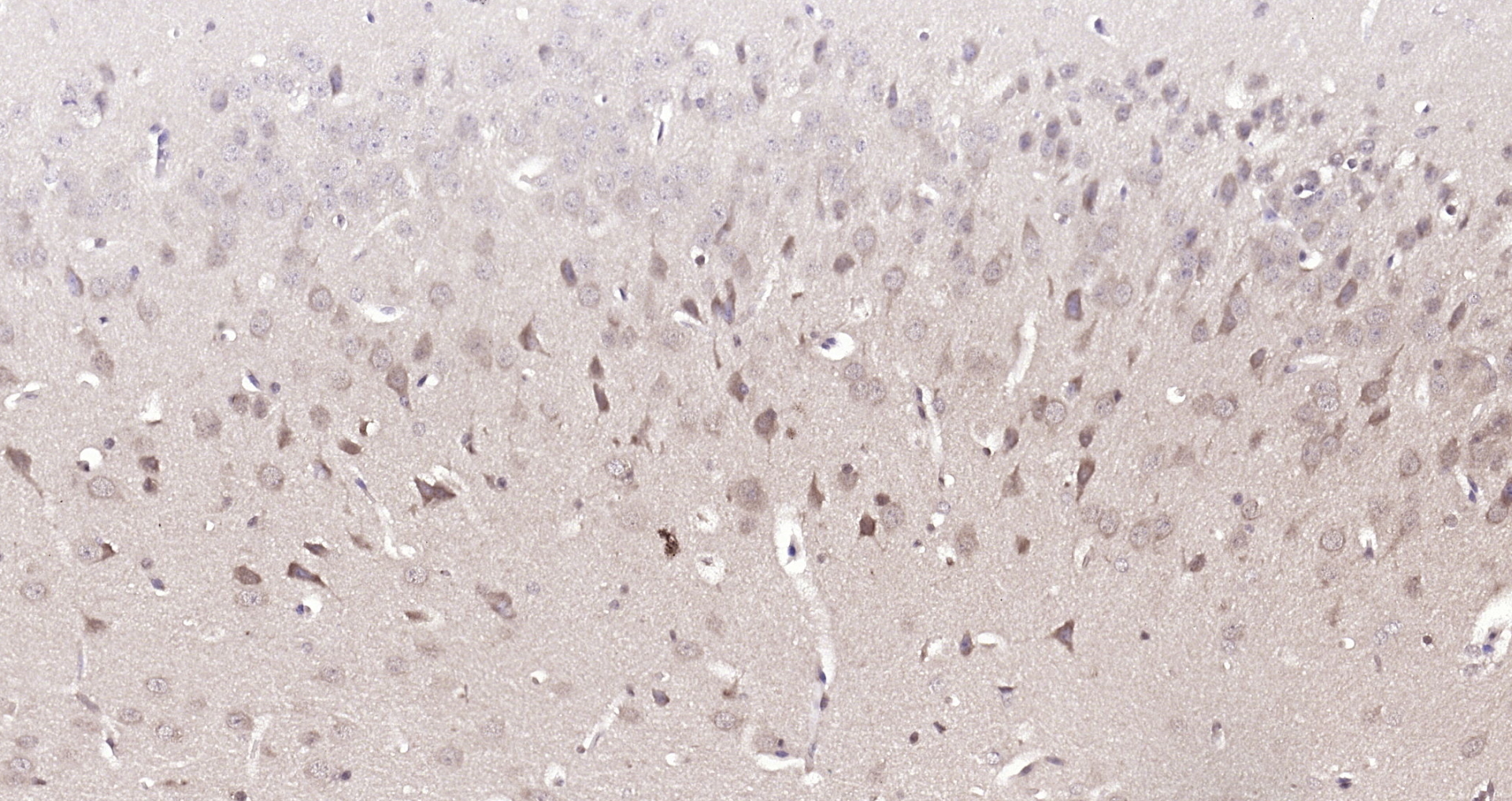 Paraformaldehyde-fixed, paraffin embedded (Mouse brain); Antigen retrieval by boiling in sodium citrate buffer (pH6.0) for 15min; Block endogenous peroxidase by 3% hydrogen peroxide for 20 minutes; Blocking buffer (normal goat serum) at 37°C for 30min; Antibody incubation with (DUSP10) Polyclonal Antibody, Unconjugated (bs-13035R) at 1:200 overnight at 4°C, followed by operating according to SP Kit(Rabbit) (sp-0023) instructionsand DAB staining.