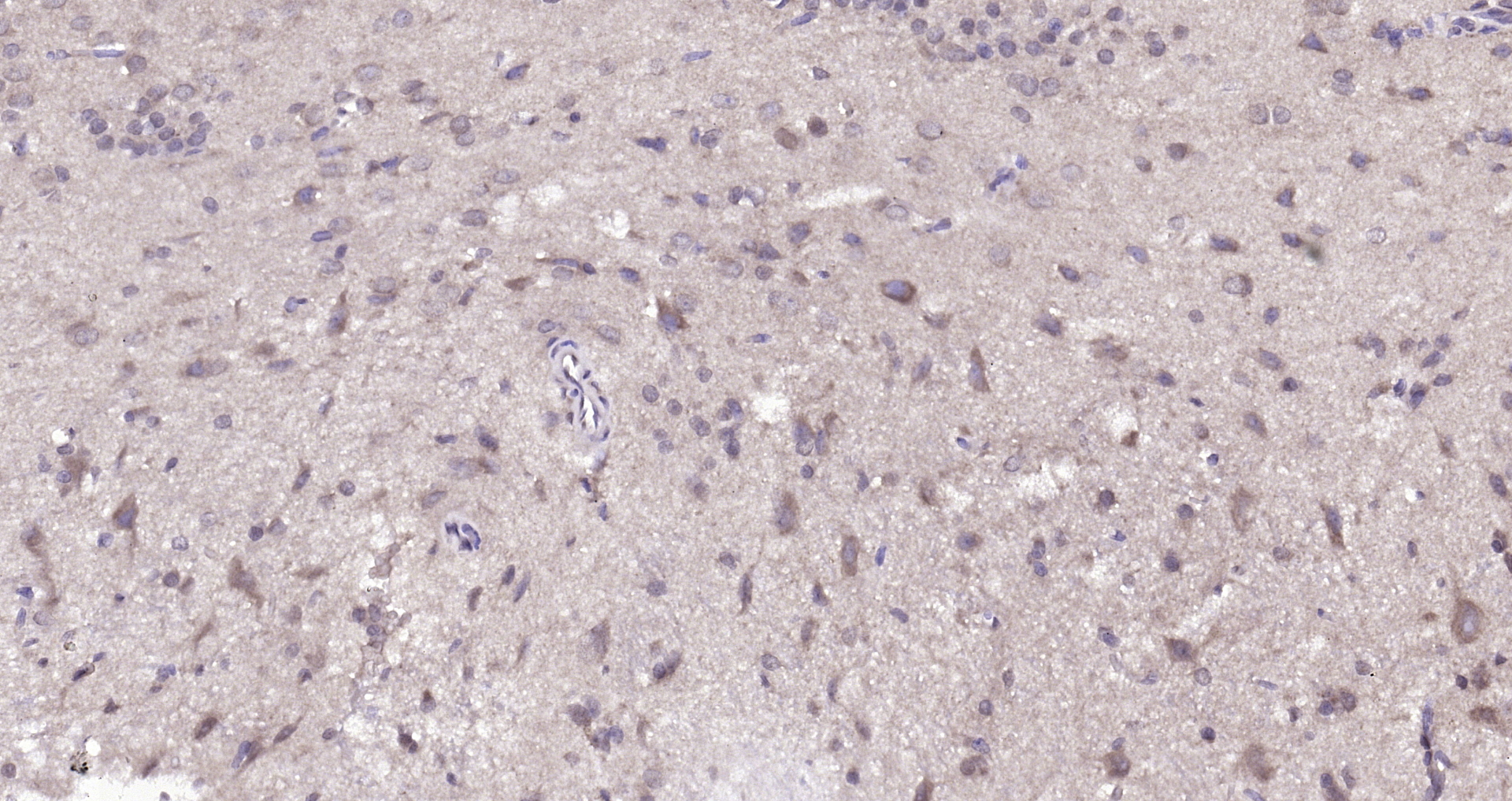 Paraformaldehyde-fixed, paraffin embedded (rat brain); Antigen retrieval by boiling in sodium citrate buffer (pH6.0) for 15min; Block endogenous peroxidase by 3% hydrogen peroxide for 20 minutes; Blocking buffer (normal goat serum) at 37°C for 30min; Antibody incubation with (DUSP10) Polyclonal Antibody, Unconjugated (bs-13035R) at 1:200 overnight at 4°C, followed by operating according to SP Kit(Rabbit) (sp-0023) instructionsand DAB staining.