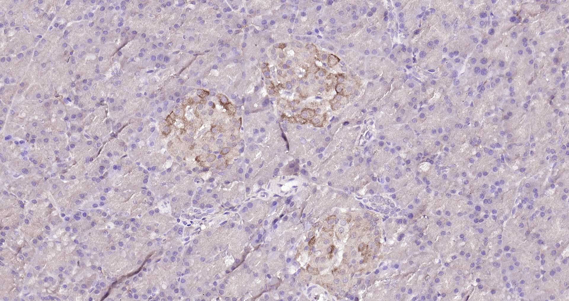 Paraformaldehyde-fixed, paraffin embedded (rat pancreas ); Antigen retrieval by boiling in sodium citrate buffer (pH6.0) for 15min; Block endogenous peroxidase by 3% hydrogen peroxide for 20 minutes; Blocking buffer (normal goat serum) at 37°C for 30min; Antibody incubation with (DUSP10) Polyclonal Antibody, Unconjugated (bs-13035R) at 1:200 overnight at 4°C, followed by operating according to SP Kit(Rabbit) (sp-0023) instructionsand DAB staining.