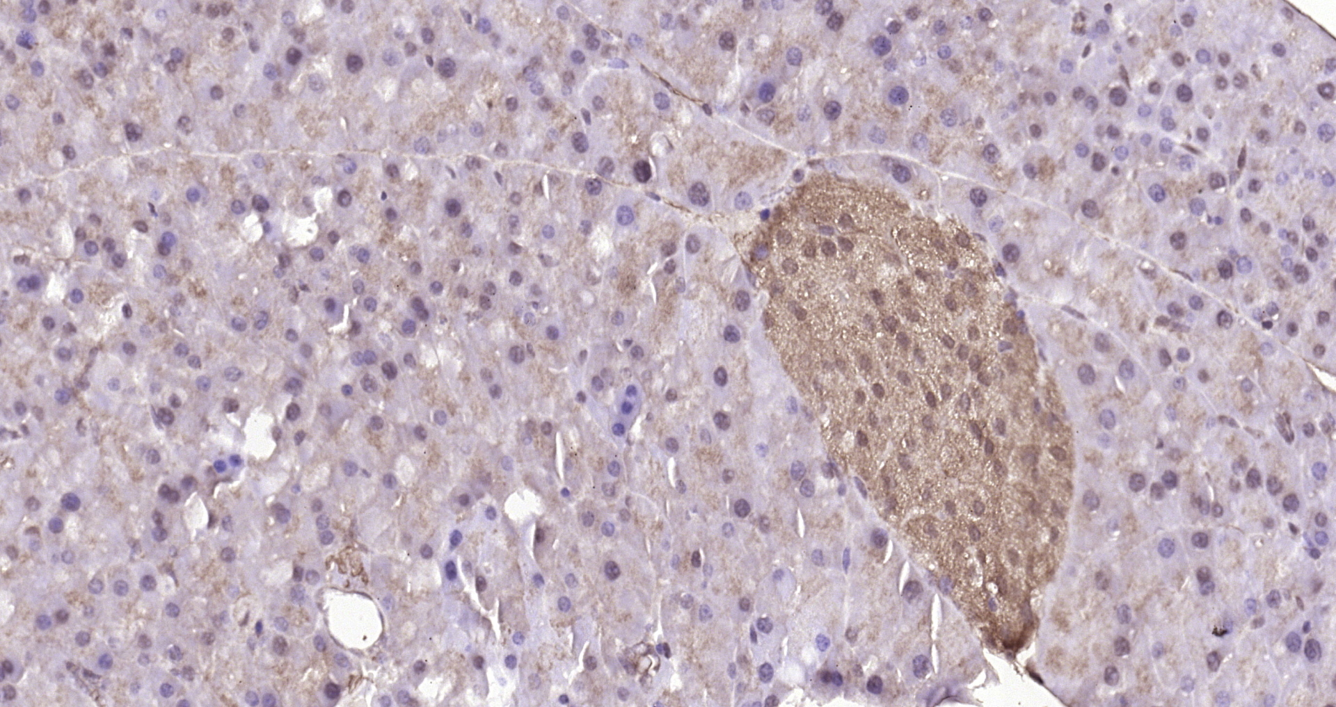 Paraformaldehyde-fixed, paraffin embedded (mouse pancreas ); Antigen retrieval by boiling in sodium citrate buffer (pH6.0) for 15min; Block endogenous peroxidase by 3% hydrogen peroxide for 20 minutes; Blocking buffer (normal goat serum) at 37°C for 30min; Antibody incubation with (DUSP10) Polyclonal Antibody, Unconjugated (bs-13035R) at 1:200 overnight at 4°C, followed by operating according to SP Kit(Rabbit) (sp-0023) instructionsand DAB staining.