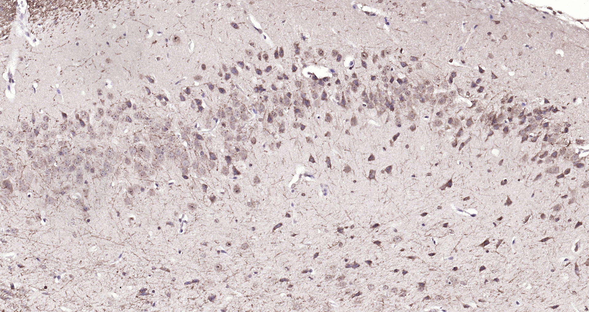 Paraformaldehyde-fixed, paraffin embedded (mouse brain); Antigen retrieval by boiling in sodium citrate buffer (pH6.0) for 15min; Block endogenous peroxidase by 3% hydrogen peroxide for 20 minutes; Blocking buffer (normal goat serum) at 37°C for 30min; Antibody incubation with (FBXO2) Polyclonal Antibody, Unconjugated (bs-13149R) at 1:200 overnight at 4°C, followed by operating according to SP Kit(Rabbit) (sp-0023) instructionsand DAB staining.