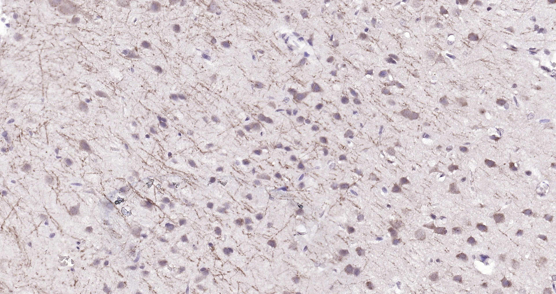 Paraformaldehyde-fixed, paraffin embedded (rat brain); Antigen retrieval by boiling in sodium citrate buffer (pH6.0) for 15min; Block endogenous peroxidase by 3% hydrogen peroxide for 20 minutes; Blocking buffer (normal goat serum) at 37°C for 30min; Antibody incubation with (FBXO2) Polyclonal Antibody, Unconjugated (bs-13149R) at 1:200 overnight at 4°C, followed by operating according to SP Kit(Rabbit) (sp-0023) instructionsand DAB staining. Paraformaldehyde-fixed, paraffin embedded (rat brain); Antigen retrieval by boiling in sodium citrate buffer (pH6.0) for 15min; Block endogenous peroxidase by 3% hydrogen peroxide for 20 minutes; Blocking buffer (normal goat serum) at 37°C for 30min; Antibody incubation with (FBXO2) Polyclonal Antibody, Unconjugated (bs-13149R) at 1:200 overnight at 4°C, followed by operating according to SP Kit(Rabbit) (sp-0023) instructionsand DAB staining.