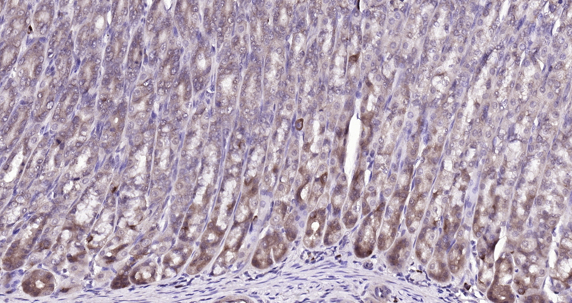 Paraformaldehyde-fixed, paraffin embedded (rat stomach); Antigen retrieval by boiling in sodium citrate buffer (pH6.0) for 15min; Block endogenous peroxidase by 3% hydrogen peroxide for 20 minutes; Blocking buffer (normal goat serum) at 37°C for 30min; Antibody incubation with (FBXO2) Polyclonal Antibody, Unconjugated (bs-13149R) at 1:200 overnight at 4°C, followed by operating according to SP Kit(Rabbit) (sp-0023) instructionsand DAB staining. Paraformaldehyde-fixed, paraffin embedded (rat stomach); Antigen retrieval by boiling in sodium citrate buffer (pH6.0) for 15min; Block endogenous peroxidase by 3% hydrogen peroxide for 20 minutes; Blocking buffer (normal goat serum) at 37°C for 30min; Antibody incubation with (FBXO2) Polyclonal Antibody, Unconjugated (bs-13149R) at 1:200 overnight at 4°C, followed by operating according to SP Kit(Rabbit) (sp-0023) instructionsand DAB staining.