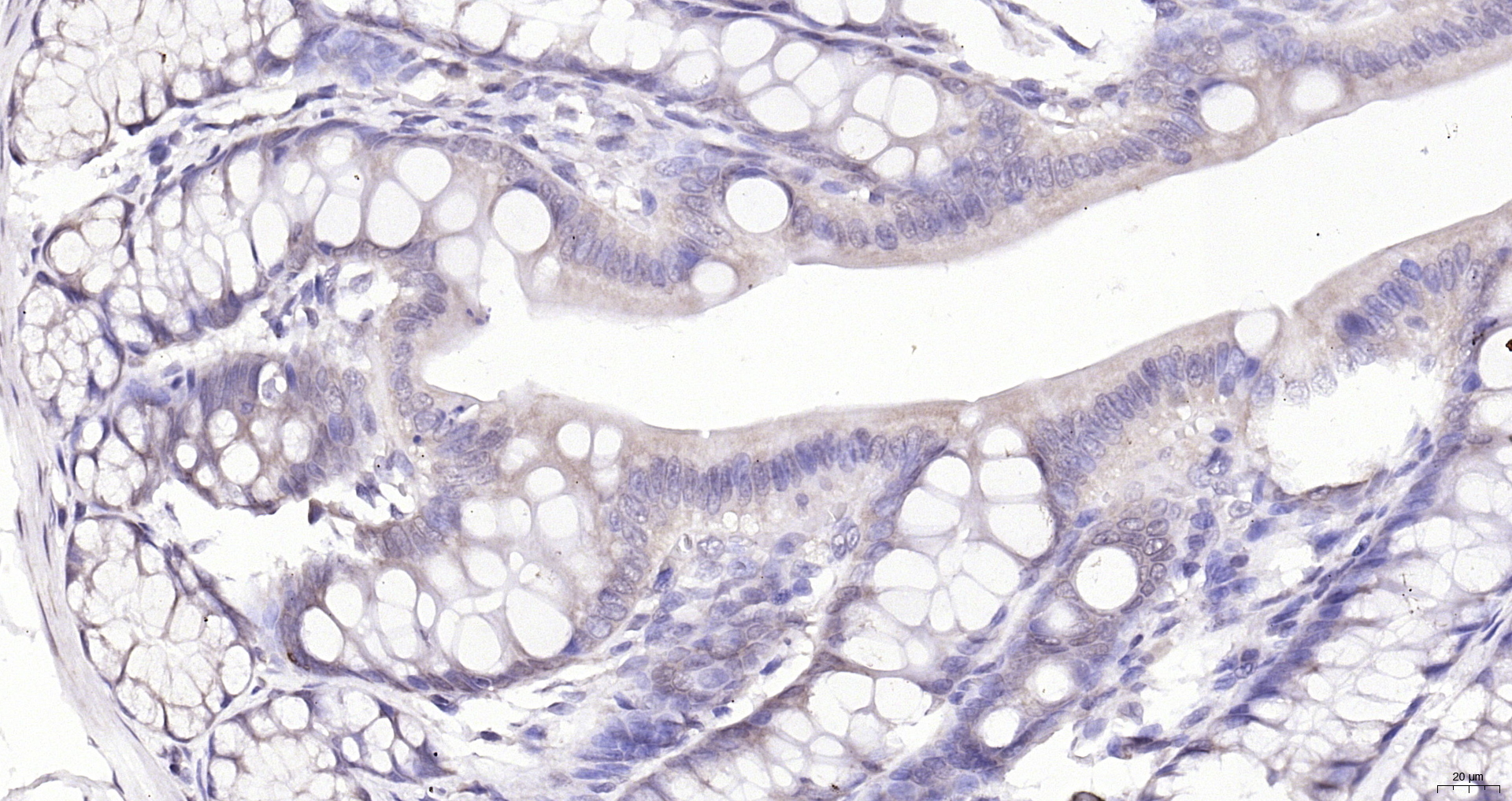 Paraformaldehyde-fixed, paraffin embedded (Rat colon); Antigen retrieval by boiling in sodium citrate buffer (pH6.0) for 15min; Block endogenous peroxidase by 3% hydrogen peroxide for 20 minutes; Blocking buffer (normal goat serum) at 37°C for 30min; Antibody incubation with (SMEK1) Polyclonal Antibody, Unconjugated (bs-12636R) at 1:200 overnight at 4°C, followed by operating according to SP Kit(Rabbit) (sp-0023) instructionsand DAB staining.
