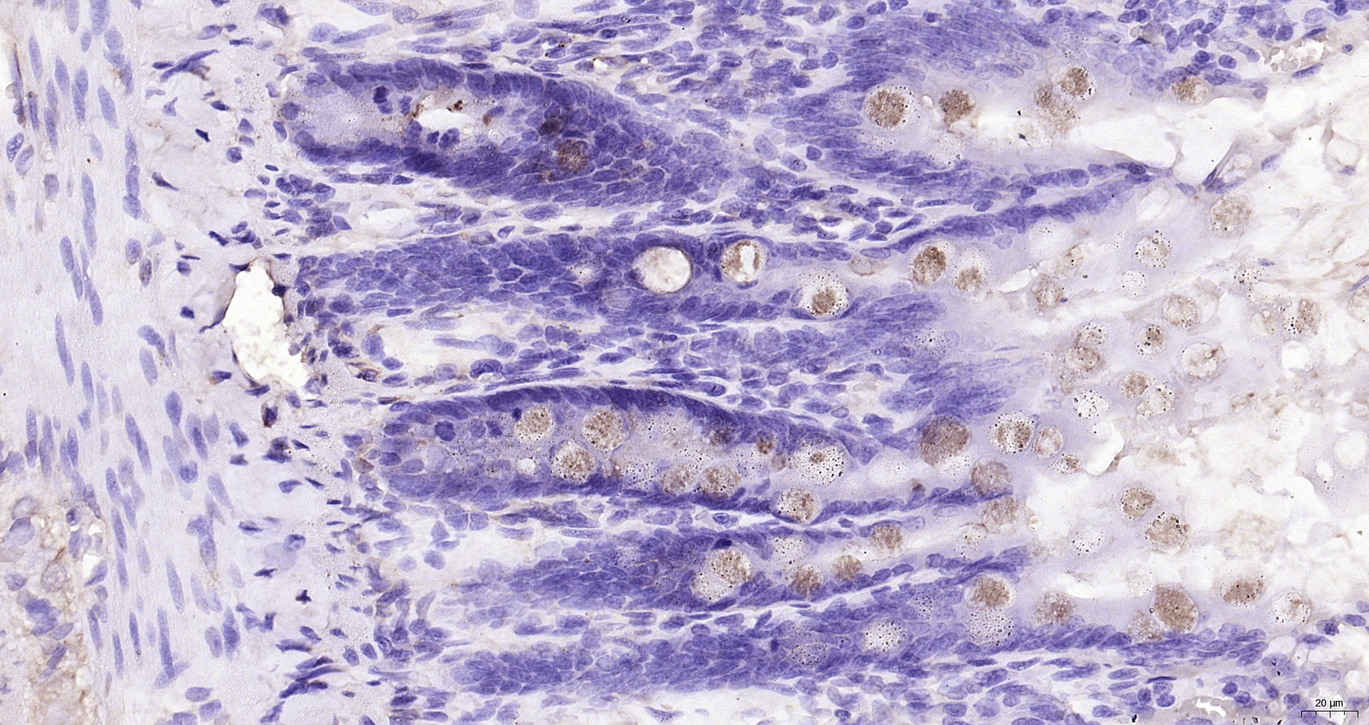 Paraformaldehyde-fixed, paraffin embedded (rat intestine); Antigen retrieval by boiling in sodium citrate buffer (pH6.0) for 15min; Block endogenous peroxidase by 3% hydrogen peroxide for 20 minutes; Blocking buffer (normal goat serum) at 37°C for 30min; Antibody incubation with (FCGBP) Polyclonal Antibody, Unconjugated (bs-13168R) at 1:200 overnight at 4°C, followed by operating according to SP Kit(Rabbit) (sp-0023) instructionsand DAB staining.