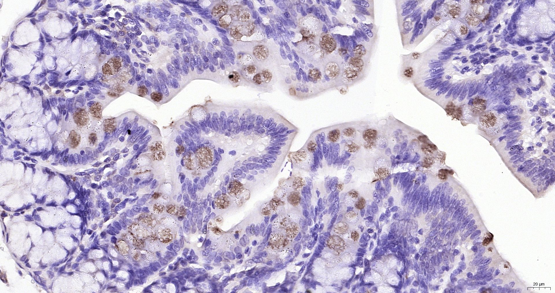 Paraformaldehyde-fixed, paraffin embedded (rat colon); Antigen retrieval by boiling in sodium citrate buffer (pH6.0) for 15min; Block endogenous peroxidase by 3% hydrogen peroxide for 20 minutes; Blocking buffer (normal goat serum) at 37°C for 30min; Antibody incubation with (FCGBP) Polyclonal Antibody, Unconjugated (bs-13168R) at 1:200 overnight at 4°C, followed by operating according to SP Kit(Rabbit) (sp-0023) instructionsand DAB staining.