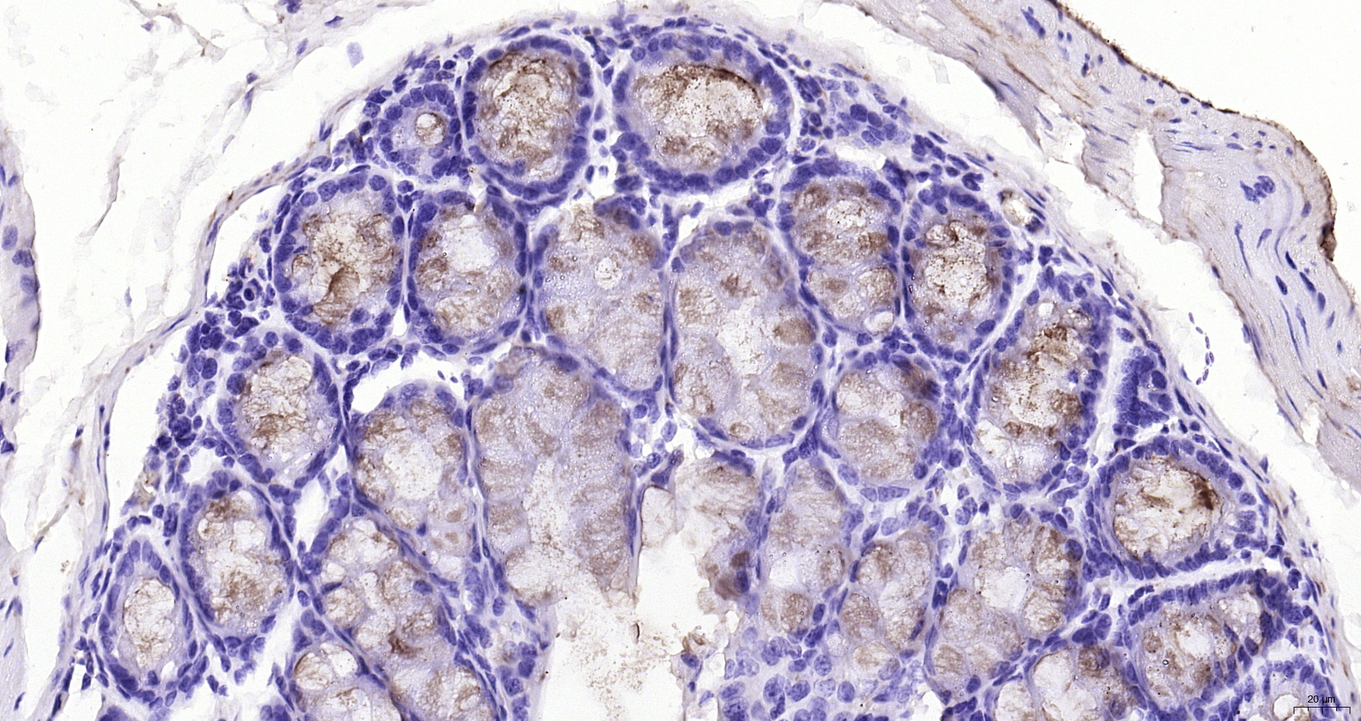 Paraformaldehyde-fixed, paraffin embedded (mouse colon); Antigen retrieval by boiling in sodium citrate buffer (pH6.0) for 15min; Block endogenous peroxidase by 3% hydrogen peroxide for 20 minutes; Blocking buffer (normal goat serum) at 37°C for 30min; Antibody incubation with (FCGBP) Polyclonal Antibody, Unconjugated (bs-13168R) at 1:200 overnight at 4°C, followed by operating according to SP Kit(Rabbit) (sp-0023) instructionsand DAB staining.