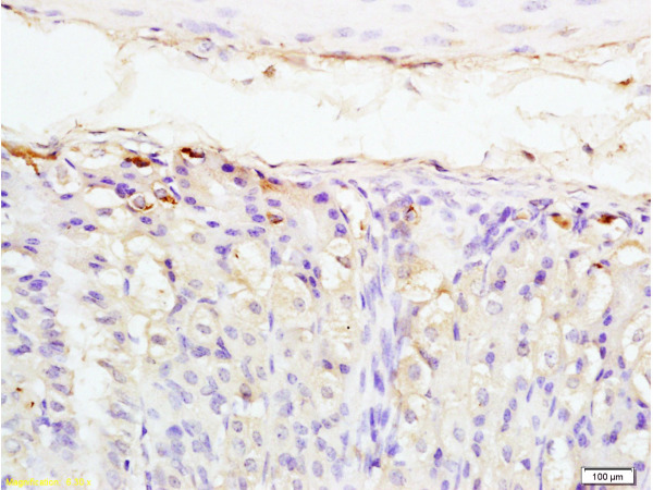 Formalin-fixed and mouse stomach tissue labeled with Anti-PTHrP/PTHLH Polyclonal Antibody, Unconjugated (bs-1107R) at 1:200 followed by conjugation to the secondary antibody and DAB staining