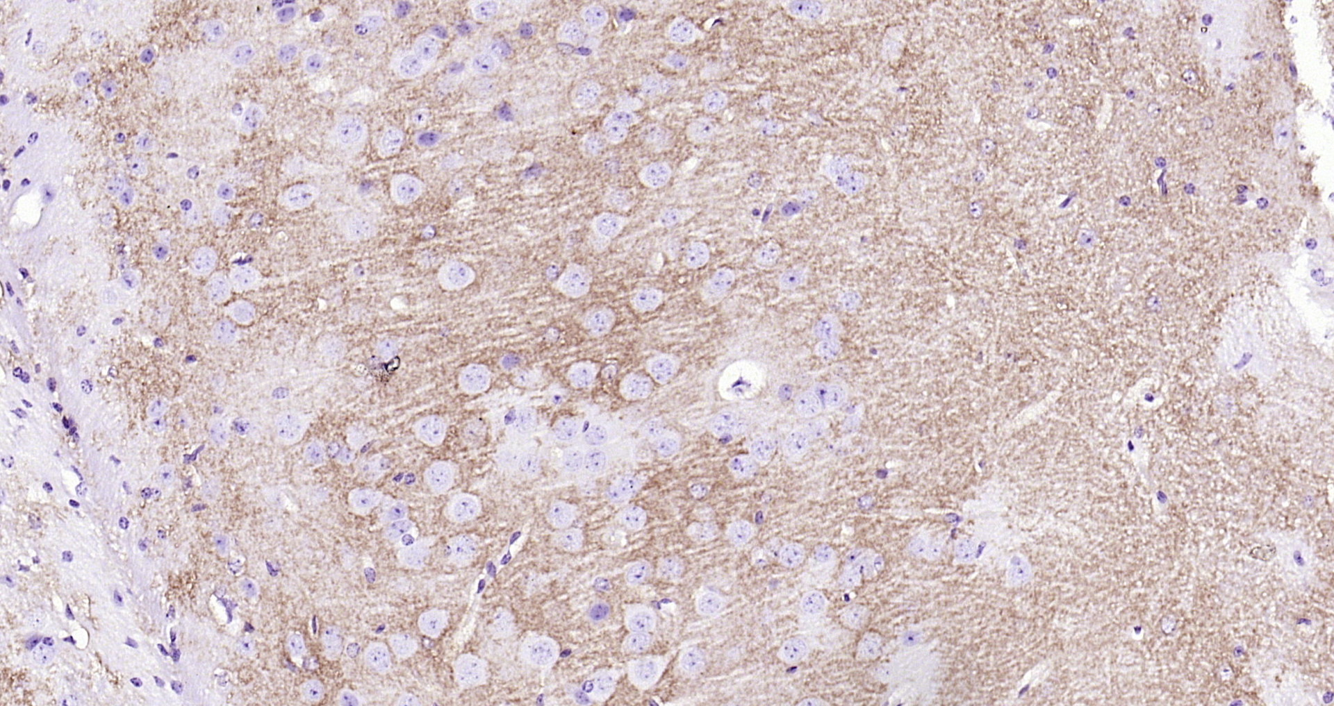Paraformaldehyde-fixed, paraffin embedded (mouse brain); Antigen retrieval by boiling in sodium citrate buffer (pH6.0) for 15min; Block endogenous peroxidase by 3% hydrogen peroxide for 20 minutes; Blocking buffer (normal goat serum) at 37°C for 30min; Antibody incubation with (EAAT1) Polyclonal Antibody, Unconjugated (bs-1003R) at 1:200 overnight at 4°C, followed by operating according to SP Kit(Rabbit) (sp-0023) instructionsand DAB staining.