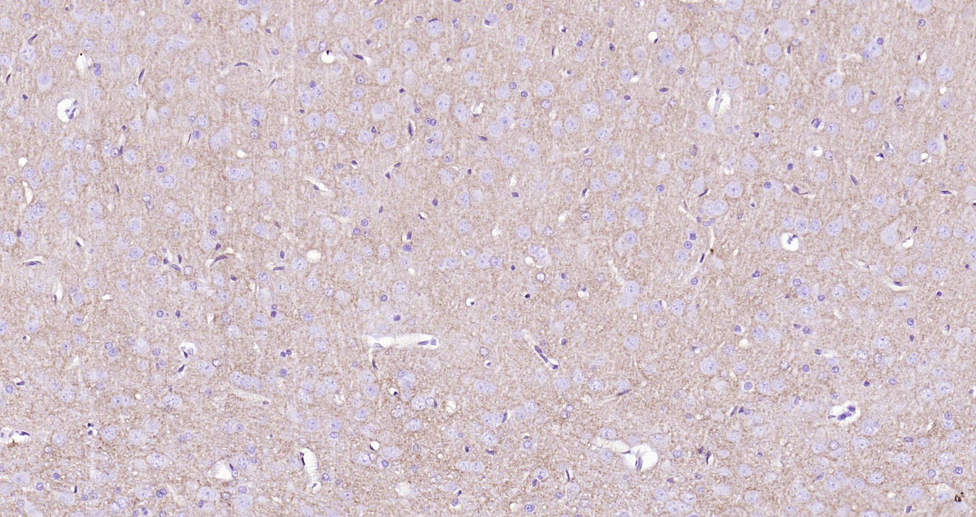 Paraformaldehyde-fixed, paraffin embedded (rat brain); Antigen retrieval by boiling in sodium citrate buffer (pH6.0) for 15min; Block endogenous peroxidase by 3% hydrogen peroxide for 20 minutes; Blocking buffer (normal goat serum) at 37°C for 30min; Antibody incubation with (EAAT1) Polyclonal Antibody, Unconjugated (bs-1003R) at 1:200 overnight at 4°C, followed by operating according to SP Kit(Rabbit) (sp-0023) instructionsand DAB staining.