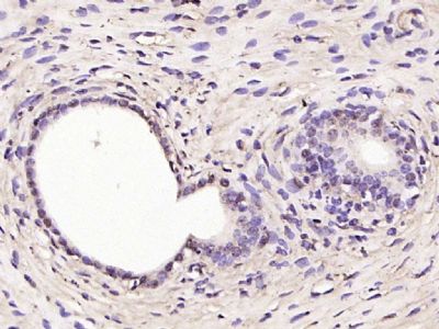 Paraformaldehyde-fixed, paraffin embedded (rat uterus); Antigen retrieval by boiling in sodium citrate buffer (pH6.0) for 15min; Block endogenous peroxidase by 3% hydrogen peroxide for 20 minutes; Blocking buffer (normal goat serum) at 37°C for 30min; Antibody incubation with (RSL1D1) Polyclonal Antibody, Unconjugated (bs-0793R ) at 1:200 overnight at 4°C, followed by operating according to SP Kit(Rabbit) (sp-0023) instructionsand DAB staining.