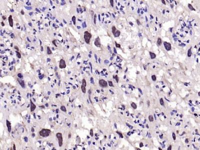 Paraformaldehyde-fixed, paraffin embedded (rat placenta); Antigen retrieval by boiling in sodium citrate buffer (pH6.0) for 15min; Block endogenous peroxidase by 3% hydrogen peroxide for 20 minutes; Blocking buffer (normal goat serum) at 37°C for 30min; Antibody incubation with (EGFR) Polyclonal Antibody, Unconjugated (bs-0165R) at 1:200 overnight at 4°C, followed by operating according to SP Kit(Rabbit) (sp-0023) instructionsand DAB staining.