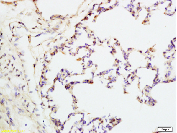 Formalin-fixed and rat lung tissue labeled with Anti-IQGAP1 Polyclonal Antibody, Unconjugated (bs-1109R) at 1:200 followed by conjugation to the secondary antibody and DAB staining