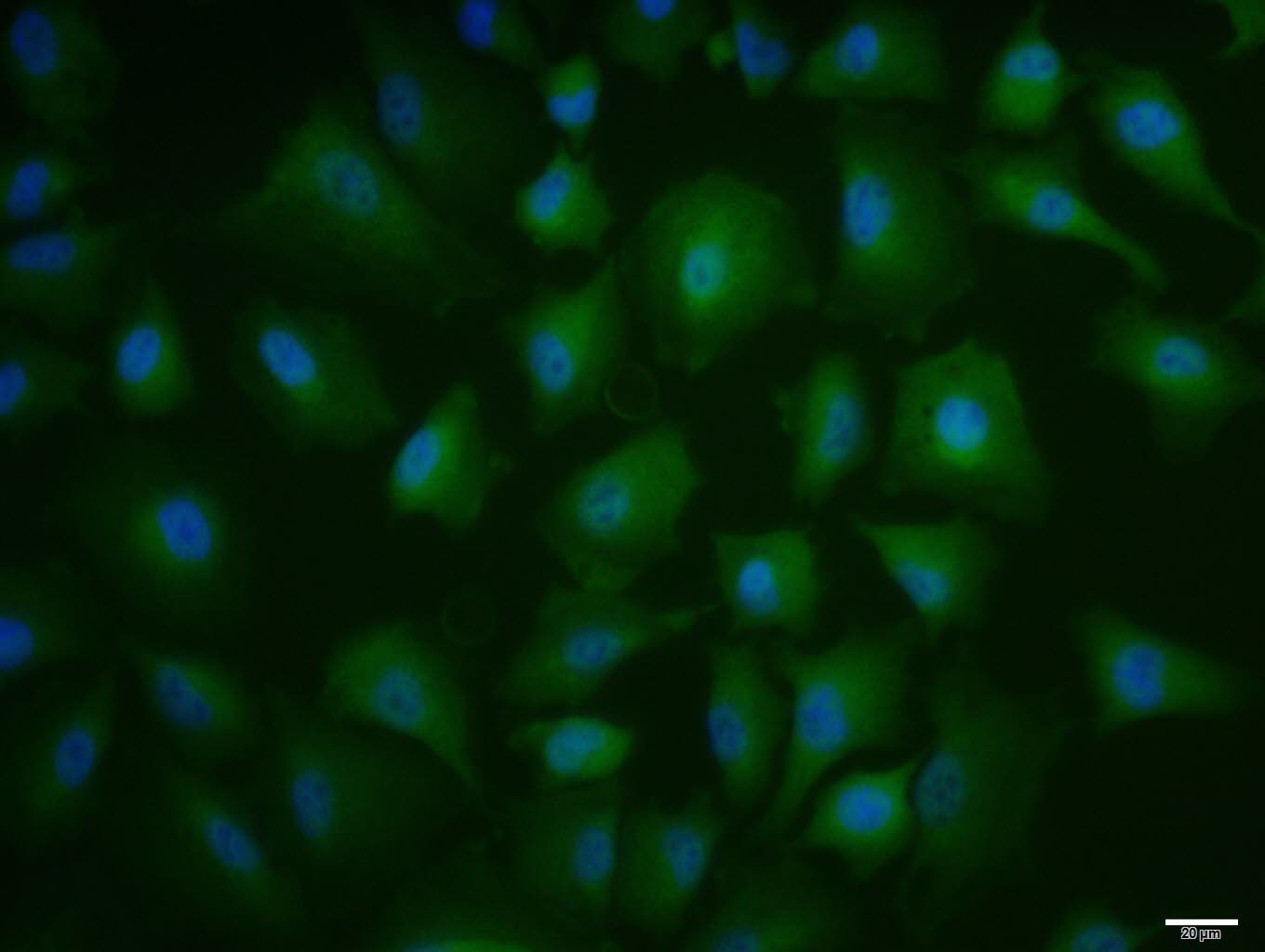 A549 cell; 4% Paraformaldehyde-fixed; Triton X-100 at room temperature for 20 min; Blocking buffer (normal goat serum, C-0005) at 37°C for 20 min; Antibody incubation with (Annexin A1) polyclonal Antibody, Unconjugated (bs-1562R) 1:100, 90 minutes at 37°C; followed by a conjugated Goat Anti-Rabbit IgG antibody at 37°C for 90 minutes, DAPI (blue, C02-04002) was used to stain the cell nuclei.