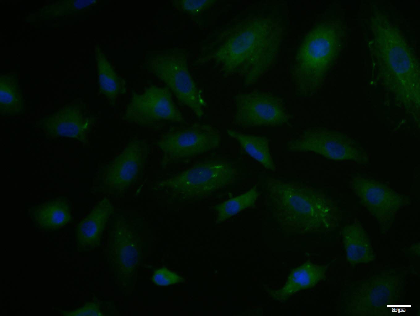 A549 cell; 4% Paraformaldehyde-fixed; Triton X-100 at room temperature for 20 min; Blocking buffer (normal goat serum, C-0005) at 37\u00b0C for 20 min; Antibody incubation with (PAI1) polyclonal Antibody, Unconjugated (bs-1704R1) 1:100, 90 minutes at 37\u00b0C; followed by a conjugated Goat Anti-Rabbit IgG antibody at 37\u00b0C for 90 minutes, DAPI (blue, C02-04002) was used to stain the cell nuclei.