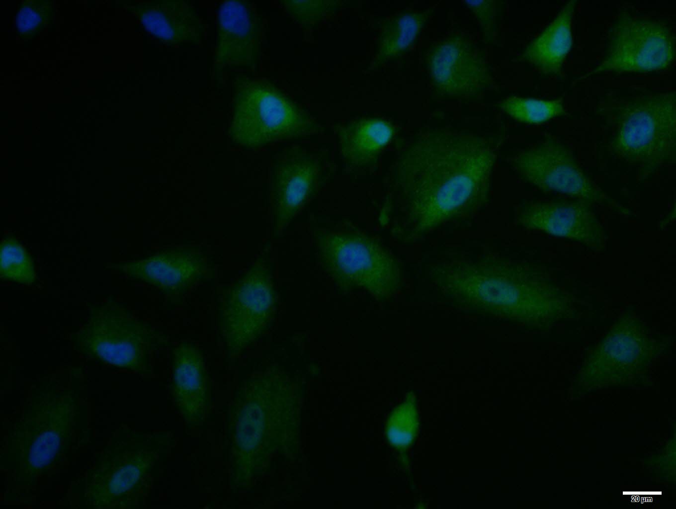 A549 cell; 4% Paraformaldehyde-fixed; Triton X-100 at room temperature for 20 min; Blocking buffer (normal goat serum, C-0005) at 37°C for 20 min; Antibody incubation with (IL-15) polyclonal Antibody, Unconjugated (bs-1829R) 1:100, 90 minutes at 37°C; followed by a conjugated Goat Anti-Rabbit IgG antibody at 37°C for 90 minutes, DAPI (blue, C02-04002) was used to stain the cell nuclei.