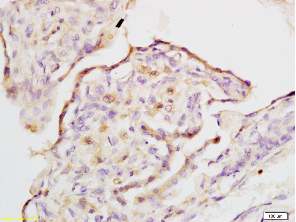 Formalin-fixed and rabbit placenta tissue labeled with Anti-IQGAP1 Polyclonal Antibody, Unconjugated (bs-1109R) at 1:200 followed by conjugation to the secondary antibody and DAB staining