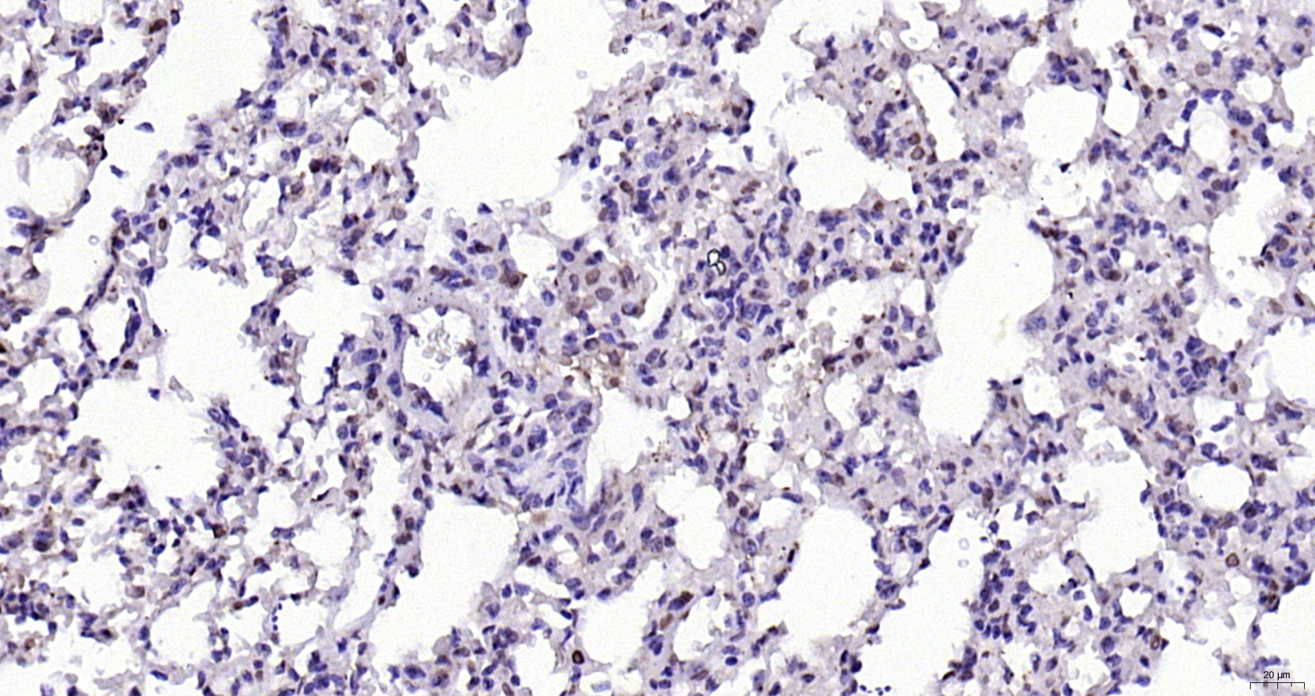 Paraformaldehyde-fixed, paraffin embedded (mouse lung); Antigen retrieval by boiling in sodium citrate buffer (pH6.0) for 15min; Block endogenous peroxidase by 3% hydrogen peroxide for 20 minutes; Blocking buffer (normal goat serum) at 37°C for 30min; Antibody incubation with (SBNO1) Polyclonal Antibody, Unconjugated (bs-17251R) at 1:200 overnight at 4°C, followed by operating according to SP Kit(Rabbit) (sp-0023) instructionsand DAB staining. Paraformaldehyde-fixed, paraffin embedded (mouse lung); Antigen retrieval by boiling in sodium citrate buffer (pH6.0) for 15min; Block endogenous peroxidase by 3% hydrogen peroxide for 20 minutes; Blocking buffer (normal goat serum) at 37°C for 30min; Antibody incubation with (SBNO1) Polyclonal Antibody, Unconjugated (bs-17251R) at 1:200 overnight at 4°C, followed by operating according to SP Kit(Rabbit) (sp-0023) instructionsand DAB staining.