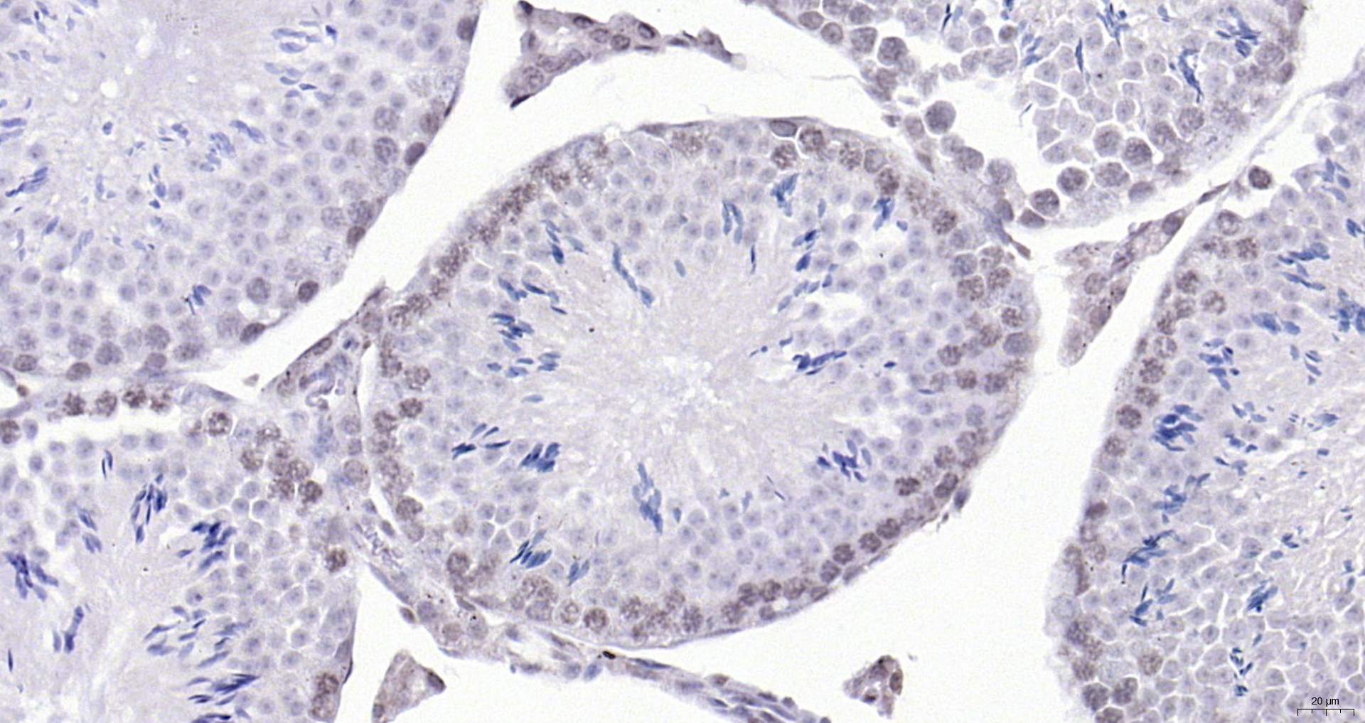 Paraformaldehyde-fixed, paraffin embedded (mouse testis); Antigen retrieval by boiling in sodium citrate buffer (pH6.0) for 15min; Block endogenous peroxidase by 3% hydrogen peroxide for 20 minutes; Blocking buffer (normal goat serum) at 37°C for 30min; Antibody incubation with (SBNO1) Polyclonal Antibody, Unconjugated (bs-17251R) at 1:200 overnight at 4°C, followed by operating according to SP Kit(Rabbit) (sp-0023) instructionsand DAB staining. Paraformaldehyde-fixed, paraffin embedded (mouse testis); Antigen retrieval by boiling in sodium citrate buffer (pH6.0) for 15min; Block endogenous peroxidase by 3% hydrogen peroxide for 20 minutes; Blocking buffer (normal goat serum) at 37°C for 30min; Antibody incubation with (SBNO1) Polyclonal Antibody, Unconjugated (bs-17251R) at 1:200 overnight at 4°C, followed by operating according to SP Kit(Rabbit) (sp-0023) instructionsand DAB staining.