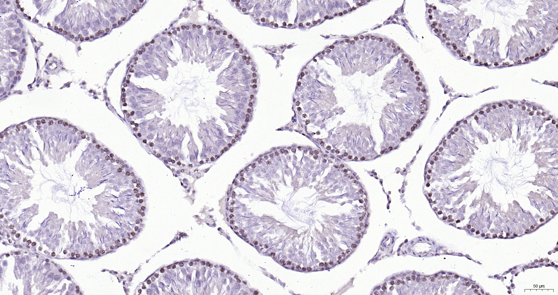 Paraformaldehyde-fixed, paraffin embedded (rat testis); Antigen retrieval by boiling in sodium citrate buffer (pH6.0) for 15min; Block endogenous peroxidase by 3% hydrogen peroxide for 20 minutes; Blocking buffer (normal goat serum) at 37°C for 30min; Antibody incubation with (SBNO1) Polyclonal Antibody, Unconjugated (bs-17251R) at 1:200 overnight at 4°C, followed by operating according to SP Kit(Rabbit) (sp-0023) instructionsand DAB staining. Paraformaldehyde-fixed, paraffin embedded (rat testis); Antigen retrieval by boiling in sodium citrate buffer (pH6.0) for 15min; Block endogenous peroxidase by 3% hydrogen peroxide for 20 minutes; Blocking buffer (normal goat serum) at 37°C for 30min; Antibody incubation with (SBNO1) Polyclonal Antibody, Unconjugated (bs-17251R) at 1:200 overnight at 4°C, followed by operating according to SP Kit(Rabbit) (sp-0023) instructionsand DAB staining.