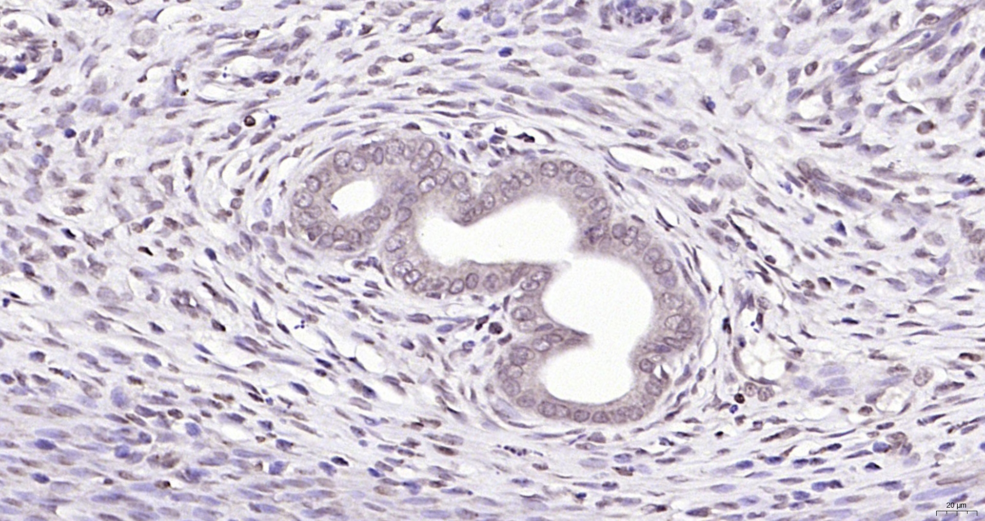 Paraformaldehyde-fixed, paraffin embedded (rat uterus); Antigen retrieval by boiling in sodium citrate buffer (pH6.0) for 15min; Block endogenous peroxidase by 3% hydrogen peroxide for 20 minutes; Blocking buffer (normal goat serum) at 37°C for 30min; Antibody incubation with (SBNO1) Polyclonal Antibody, Unconjugated (bs-17251R) at 1:200 overnight at 4°C, followed by operating according to SP Kit(Rabbit) (sp-0023) instructionsand DAB staining. Paraformaldehyde-fixed, paraffin embedded (rat uterus); Antigen retrieval by boiling in sodium citrate buffer (pH6.0) for 15min; Block endogenous peroxidase by 3% hydrogen peroxide for 20 minutes; Blocking buffer (normal goat serum) at 37°C for 30min; Antibody incubation with (SBNO1) Polyclonal Antibody, Unconjugated (bs-17251R) at 1:200 overnight at 4°C, followed by operating according to SP Kit(Rabbit) (sp-0023) instructionsand DAB staining.