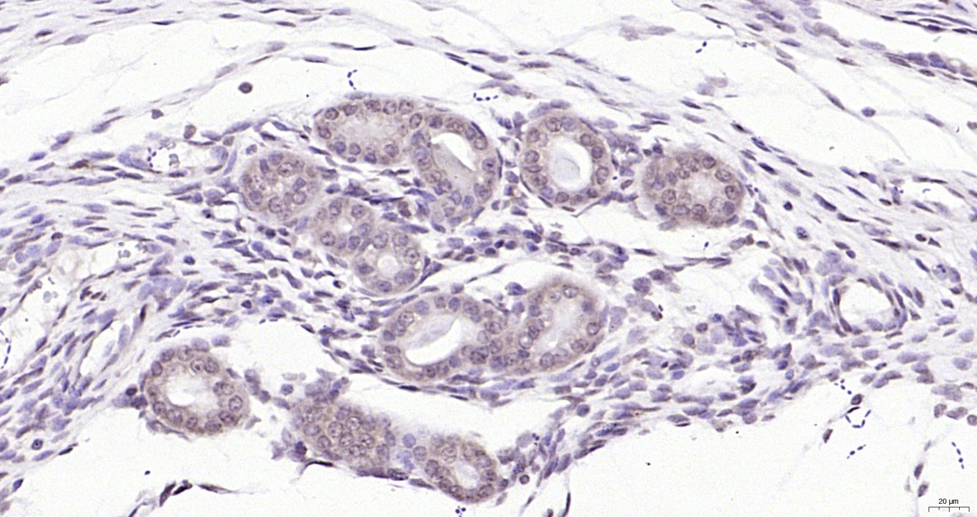 Paraformaldehyde-fixed, paraffin embedded (mouse uterus); Antigen retrieval by boiling in sodium citrate buffer (pH6.0) for 15min; Block endogenous peroxidase by 3% hydrogen peroxide for 20 minutes; Blocking buffer (normal goat serum) at 37°C for 30min; Antibody incubation with (SBNO1) Polyclonal Antibody, Unconjugated (bs-17251R) at 1:200 overnight at 4°C, followed by operating according to SP Kit(Rabbit) (sp-0023) instructionsand DAB staining. Paraformaldehyde-fixed, paraffin embedded (mouse uterus); Antigen retrieval by boiling in sodium citrate buffer (pH6.0) for 15min; Block endogenous peroxidase by 3% hydrogen peroxide for 20 minutes; Blocking buffer (normal goat serum) at 37°C for 30min; Antibody incubation with (SBNO1) Polyclonal Antibody, Unconjugated (bs-17251R) at 1:200 overnight at 4°C, followed by operating according to SP Kit(Rabbit) (sp-0023) instructionsand DAB staining.