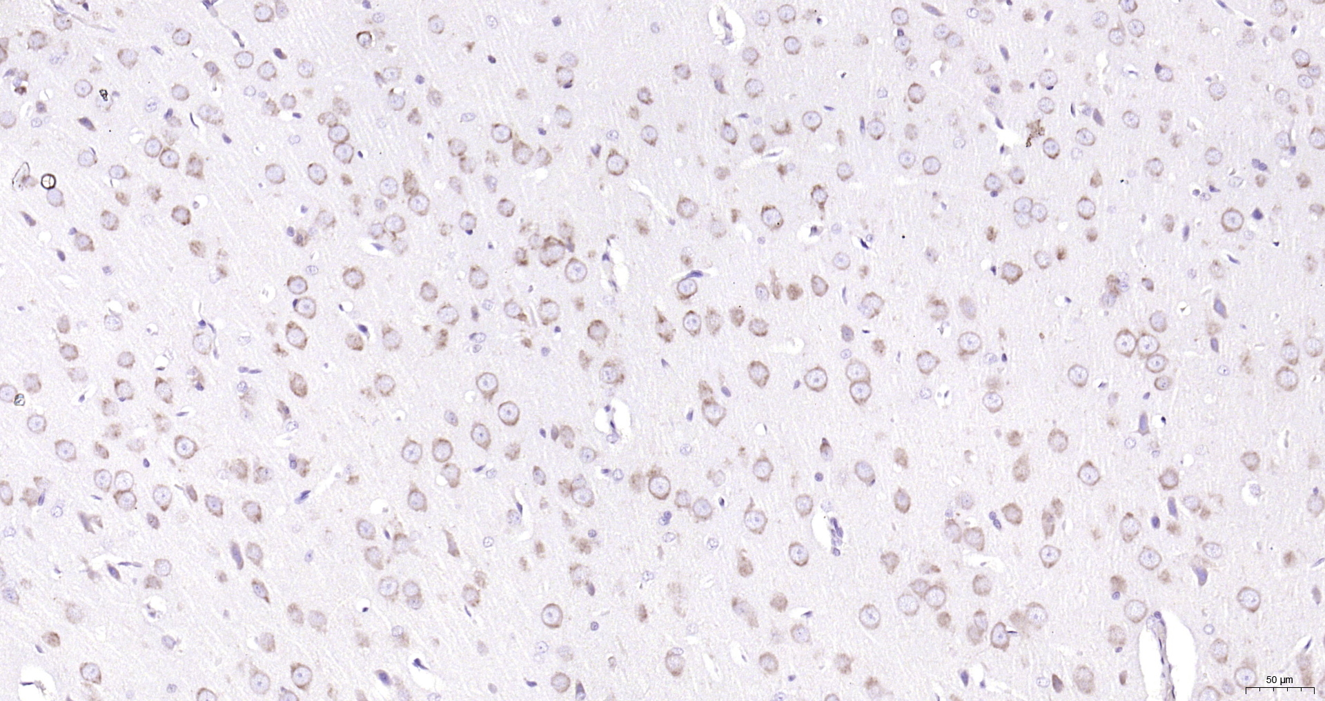 Paraformaldehyde-fixed, paraffin embedded (rat brain); Antigen retrieval by boiling in sodium citrate buffer (pH6.0) for 15min; Block endogenous peroxidase by 3% hydrogen peroxide for 20 minutes; Blocking buffer (normal goat serum) at 37°C for 30min; Antibody incubation with (GRP94) Polyclonal Antibody, Unconjugated (bs-0194R) at 1:200 overnight at 4°C, followed by operating according to SP Kit(Rabbit) (sp-0023) instructionsand DAB staining.