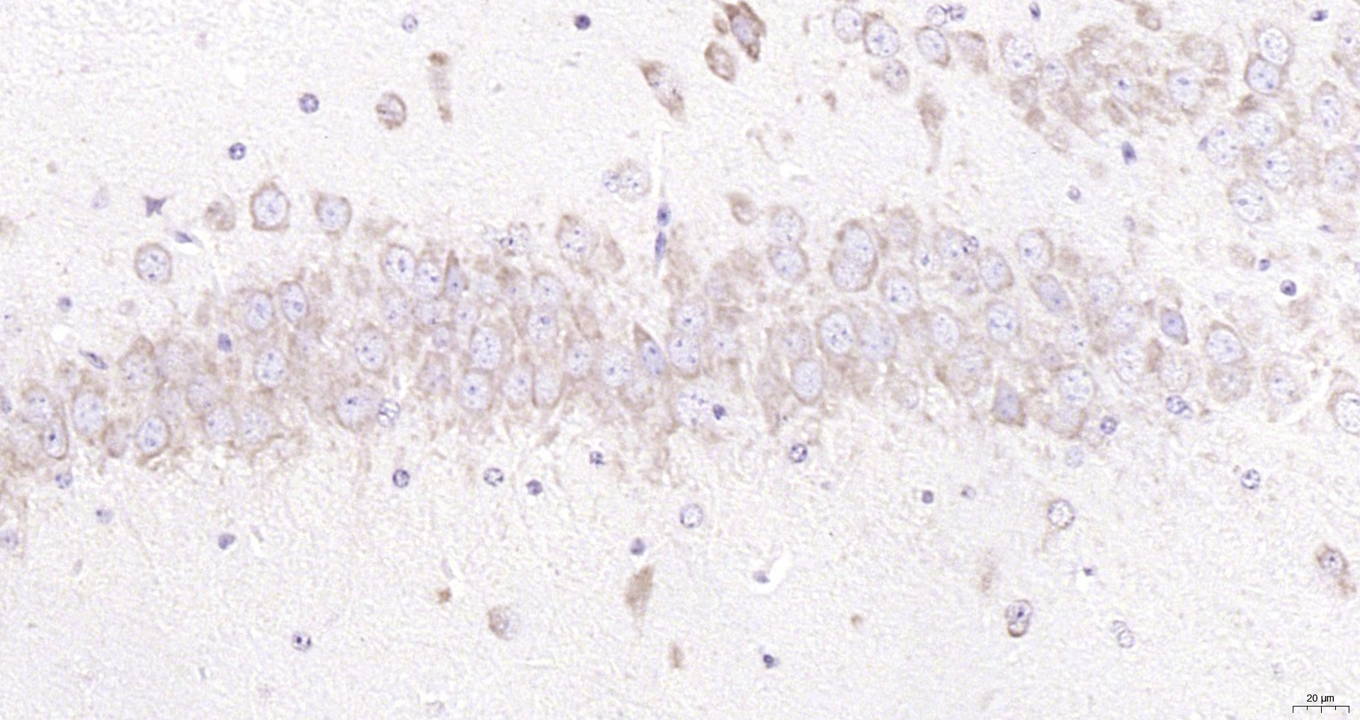 Paraformaldehyde-fixed, paraffin embedded (mouse brain); Antigen retrieval by boiling in sodium citrate buffer (pH6.0) for 15min; Block endogenous peroxidase by 3% hydrogen peroxide for 20 minutes; Blocking buffer (normal goat serum) at 37°C for 30min; Antibody incubation with (GRP94) Polyclonal Antibody, Unconjugated (bs-0194R) at 1:200 overnight at 4°C, followed by operating according to SP Kit(Rabbit) (sp-0023) instructionsand DAB staining.