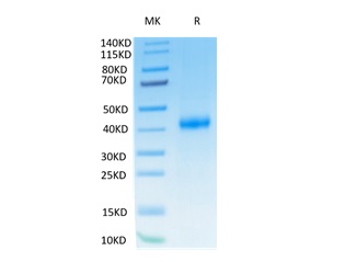 Human CD122\/IL2RB on Tris-Bis PAGE under reduced condition. The purity is greater than 95%.