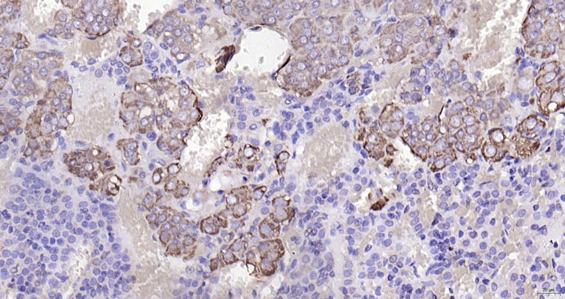 Paraformaldehyde-fixed, paraffin embedded (rat adrenal gland); Antigen retrieval by boiling in sodium citrate buffer (pH6.0) for 15min; Block endogenous peroxidase by 3% hydrogen peroxide for 20 minutes; Blocking buffer (normal goat serum) at 37°C for 30min; Antibody incubation with (CHRNA7) Polyclonal Antibody, Unconjugated (bs-1049R) at 1:200 overnight at 4°C, followed by operating according to SP Kit(Rabbit) (sp-0023) instructionsand DAB staining.