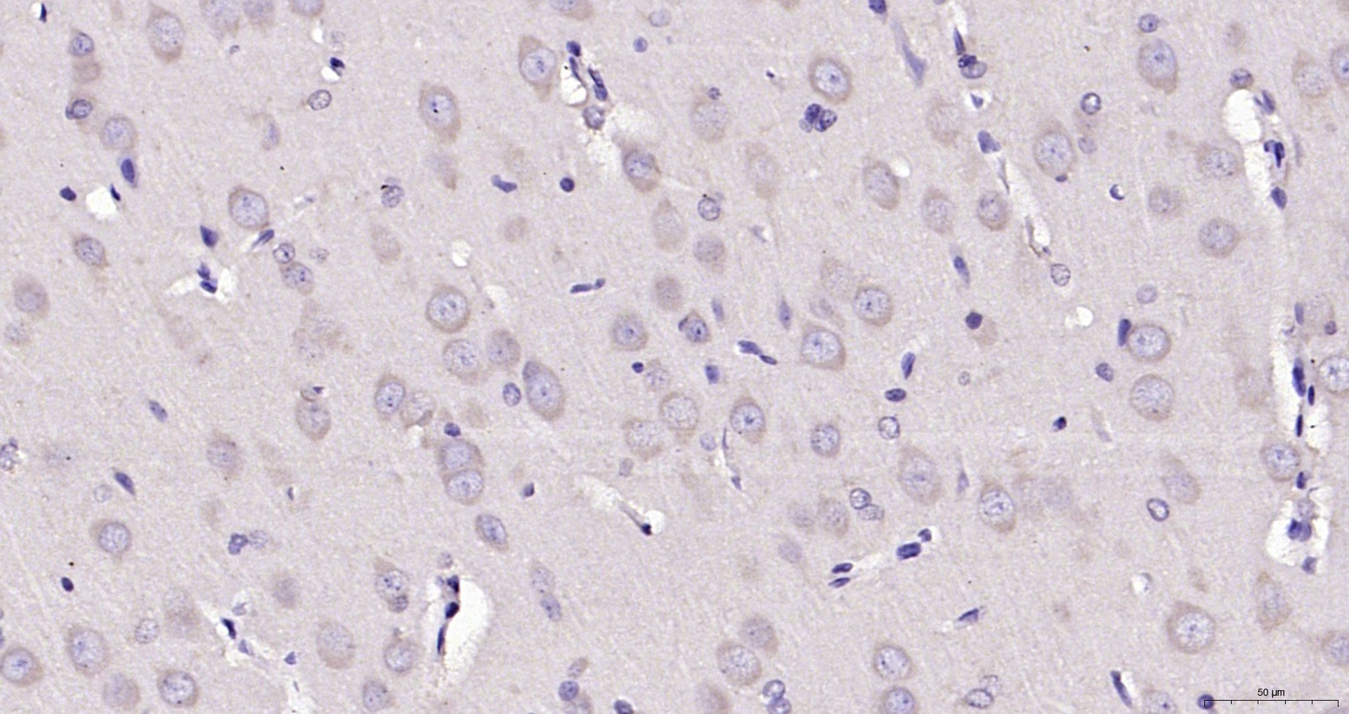 Paraformaldehyde-fixed, paraffin embedded (rat brain); Antigen retrieval by boiling in sodium citrate buffer (pH6.0) for 15min; Block endogenous peroxidase by 3% hydrogen peroxide for 20 minutes; Blocking buffer (normal goat serum) at 37°C for 30min; Antibody incubation with (EPO) Polyclonal Antibody, Unconjugated (bs-2343R) at 1:200 overnight at 4°C, followed by operating according to SP Kit(Rabbit) (sp-0023) instructionsand DAB staining. Paraformaldehyde-fixed, paraffin embedded (rat brain); Antigen retrieval by boiling in sodium citrate buffer (pH6.0) for 15min; Block endogenous peroxidase by 3% hydrogen peroxide for 20 minutes; Blocking buffer (normal goat serum) at 37°C for 30min; Antibody incubation with (EPO) Polyclonal Antibody, Unconjugated (bs-2343R) at 1:200 overnight at 4°C, followed by operating according to SP Kit(Rabbit) (sp-0023) instructionsand DAB staining.
