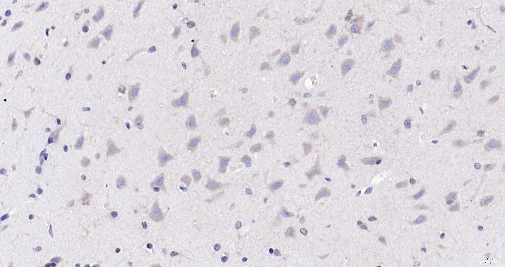 Paraformaldehyde-fixed, paraffin embedded (rat brain); Antigen retrieval by boiling in sodium citrate buffer (pH6.0) for 15min; Block endogenous peroxidase by 3% hydrogen peroxide for 20 minutes; Blocking buffer (normal goat serum) at 37°C for 30min; Antibody incubation with (Apolipoprotein E) Polyclonal Antibody, Unconjugated (bs-4892R) at 1:200 overnight at 4°C, followed by operating according to SP Kit(Rabbit) (sp-0023) instructionsand DAB staining.