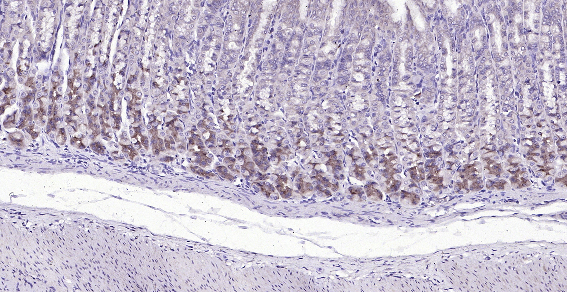 Paraformaldehyde-fixed, paraffin embedded (rat stomach); Antigen retrieval by boiling in sodium citrate buffer (pH6.0) for 15min; Block endogenous peroxidase by 3% hydrogen peroxide for 20 minutes; Blocking buffer (normal goat serum) at 37°C for 30min; Antibody incubation with (TRA1 variant) Polyclonal Antibody, Unconjugated (bs-0149R) at 1:200 overnight at 4°C, followed by operating according to SP Kit(Rabbit) (sp-0023) instructionsand DAB staining.