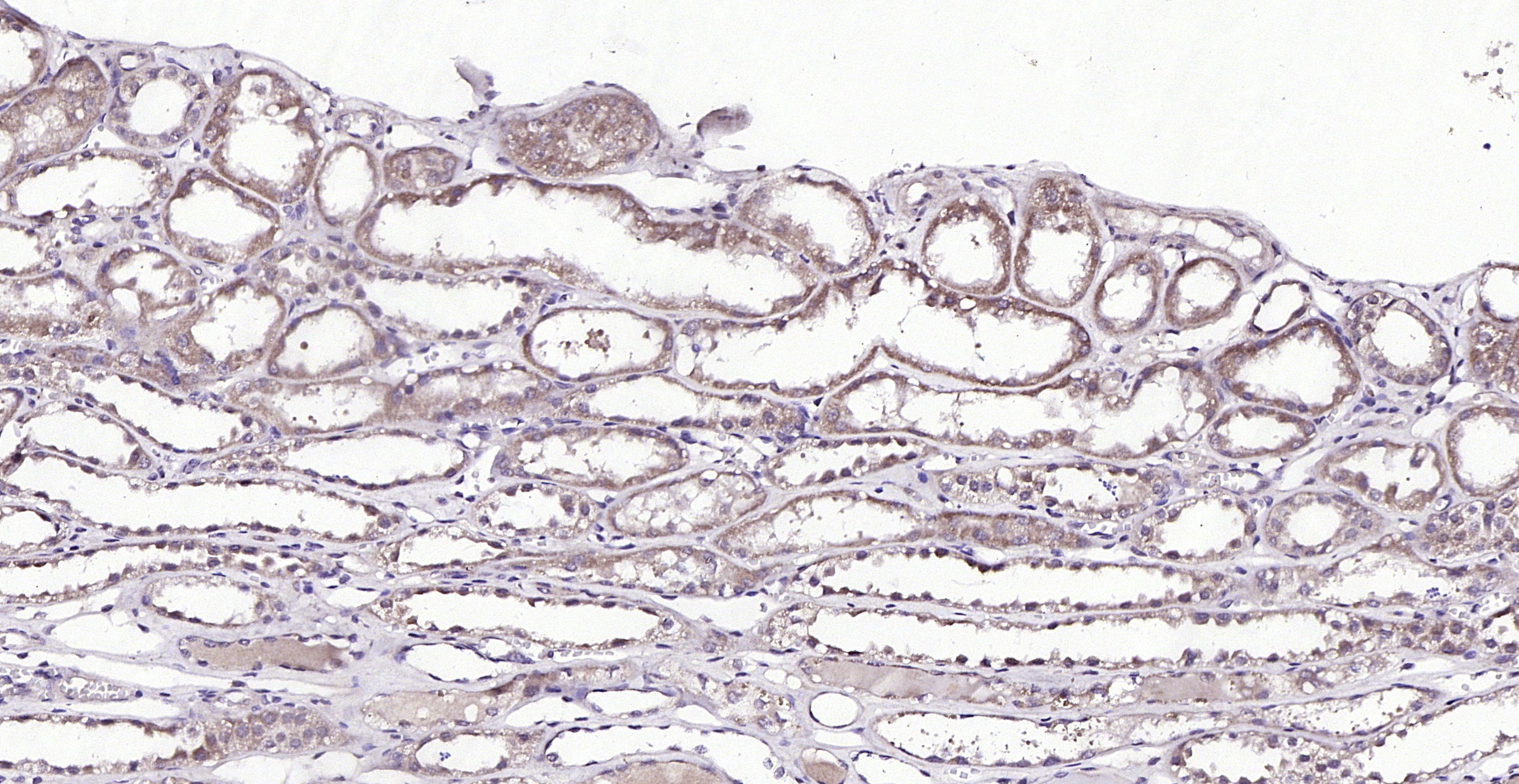 Paraformaldehyde-fixed, paraffin embedded (Human kidney); Antigen retrieval by boiling in sodium citrate buffer (pH6.0) for 15min; Block endogenous peroxidase by 3% hydrogen peroxide for 20 minutes; Blocking buffer (normal goat serum) at 37°C for 30min; Antibody incubation with (TRA1 variant) Polyclonal Antibody, Unconjugated (bs-0149R) at 1:200 overnight at 4°C, followed by operating according to SP Kit(Rabbit) (sp-0023) instructionsand DAB staining.