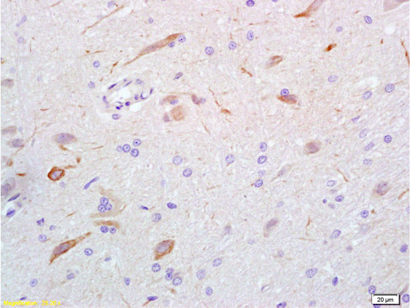 Formalin-fixed and rat brain tissue labeled with Anti-GABA Polyclonal Antibody, Unconjugated (bs-2252R) at 1:200 followed by conjugation to the secondary antibody and DAB staining