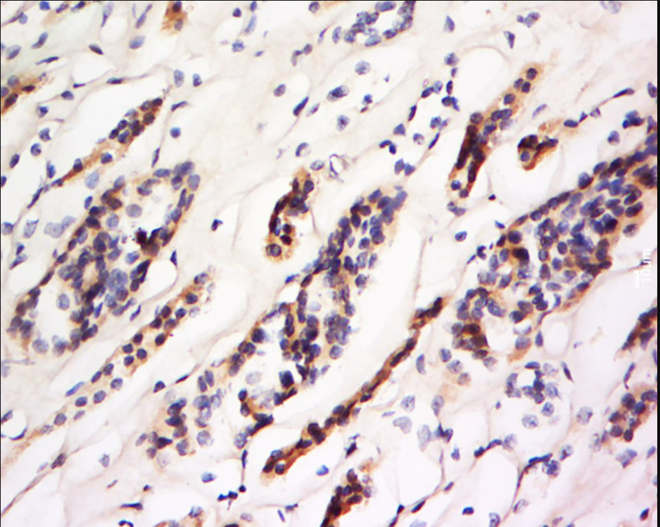 Tissue/cell: human kidney tissue; 4% Paraformaldehyde-fixed and paraffin-embedded;_x000D_ Antigen retrieval: citrate buffer ( 0.01M, pH 6.0 ), Boiling bathing for 15min; Block endogenous peroxidase by 3% Hydrogen peroxide for 30min; Blocking buffer (normal goat serum) at 37℃ for 20 min;_x000D_ Incubation: CD93/C1qrp Polyclonal Antibody, Unconjugated (bs-10232R) 1:200, overnight at 4°C, followed by conjugation to the secondary antibody and DAB staining.