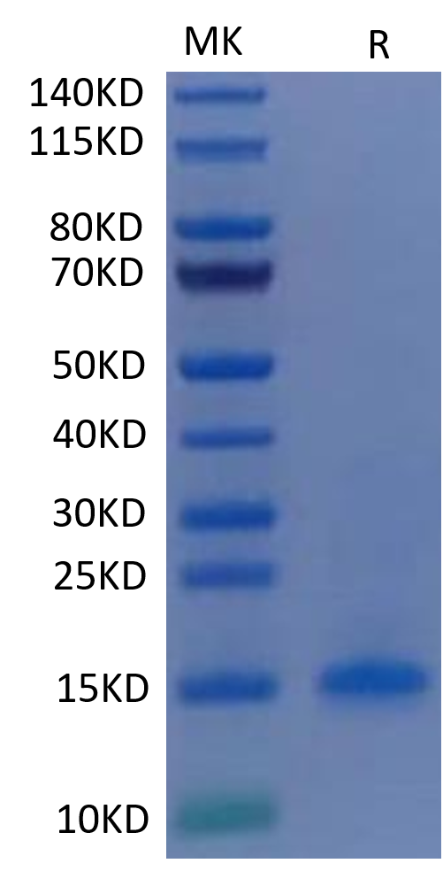 Human CD3 Delta Protein on Tris-Bis PAGE under reduced condition. The purity is greater than 95%.