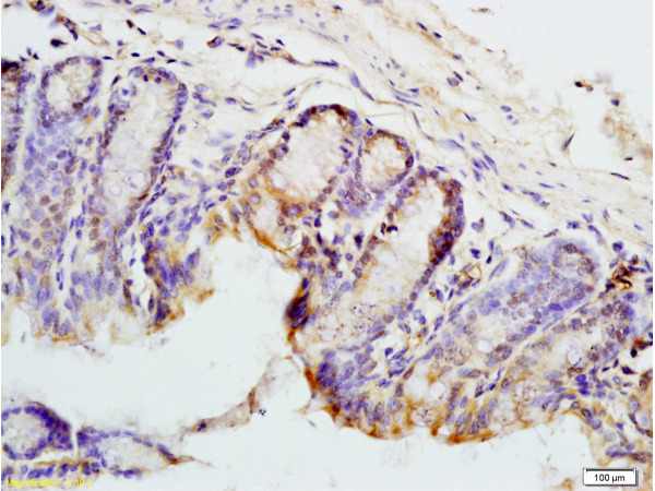 Formalin-fixed and mouse colon tissue labeled with Anti-PAX9 Polyclonal Antibody, Unconjugated (bs-1102R) at 1:200 followed by conjugation to the secondary antibody and DAB staining