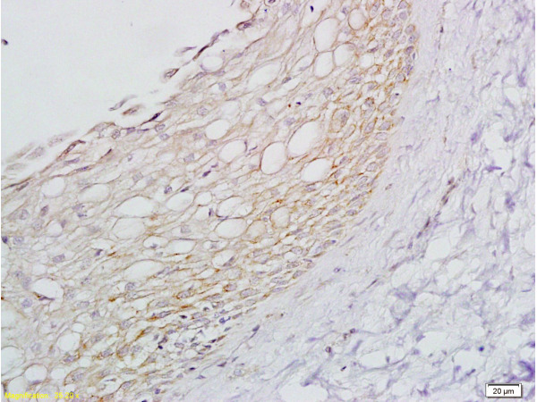 Formalin-fixed paraffin embedded  rat ovary tissue labeled with Anti-ADRB1 Polyclonal Antibody, Unconjugated (bs-0498R) at 1:200 followed by conjugation to the secondary antibody and DAB staining
