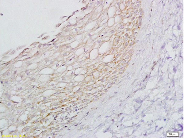 Formalin-fixed paraffin embedded rat ovary tissue labeled with Anti-ADRB1 Polyclonal Antibody, Unconjugated (bs-0498R) at 1:200 followed by conjugation to the secondary antibody and DAB staining