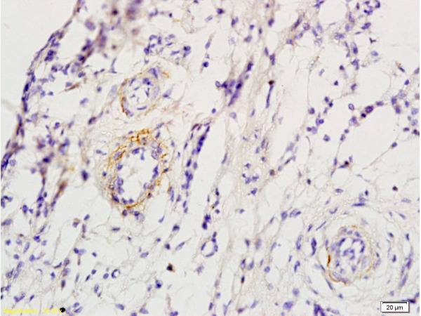 Formalin-fixed and skin of rat foot tissue labeled with Anti-ADRB1 Polyclonal Antibody, Unconjugated (bs-0498R) at 1:200 followed by conjugation to the secondary antibody and DAB staining