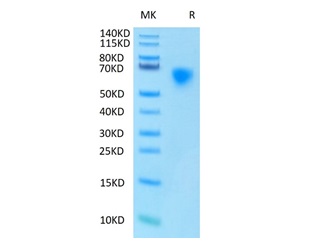 Recombinant human MICA Protein on Tris-Bis PAGE under reduced condition. The purity is greater than 95%.