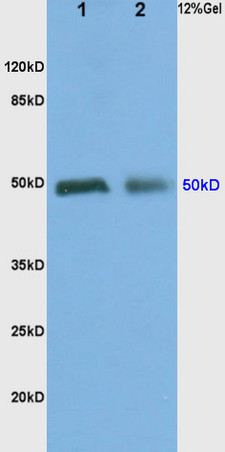 L1 rat kidney lysates, L2 rat brain lysates probed (bs-1062R) Anti-ADRA2 Polyclonal, Unconjugated at 1:200 in 4˚C. Followed by conjugation to secondary antibody (bs-0295G-HRP) at 1:3000 90min in 37˚C. Predicted band and observed band size: 50kD.