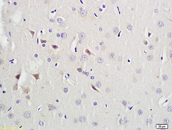 Formalin-fixed and paraffin embedded rat brain labeled with Anti-PAX9 Polyclonal Antibody, Unconjugated (bs-1102R) followed by conjugation to the secondary antibody and DAB staining