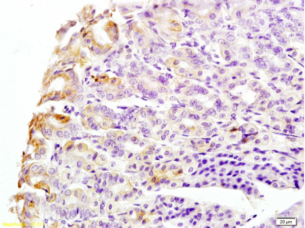 Formalin-fixed and mouse stomach tissue labeled with Anti-CK8 Polyclonal Antibody, Unconjugated (bs-1106R) at 1:200 followed by conjugation to the secondary antibody and DAB staining