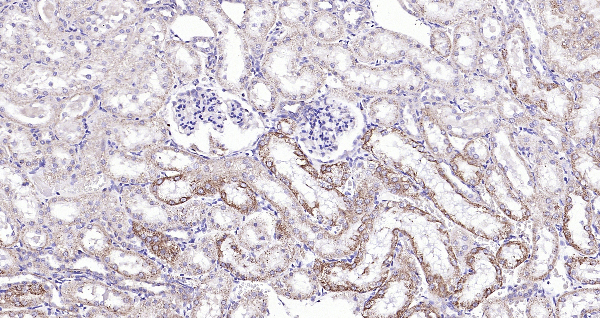 Paraformaldehyde-fixed, paraffin embedded (rat kidney); Antigen retrieval by boiling in sodium citrate buffer (pH6.0) for 15min; Block endogenous peroxidase by 3% hydrogen peroxide for 20 minutes; Blocking buffer (normal goat serum) at 37°C for 30min; Antibody incubation with (Angiopoietin-1) Polyclonal Antibody, Unconjugated (bs-0800R) at 1:200 overnight at 4°C, followed by operating according to SP Kit(Rabbit) (sp-0023) instructionsand DAB staining.