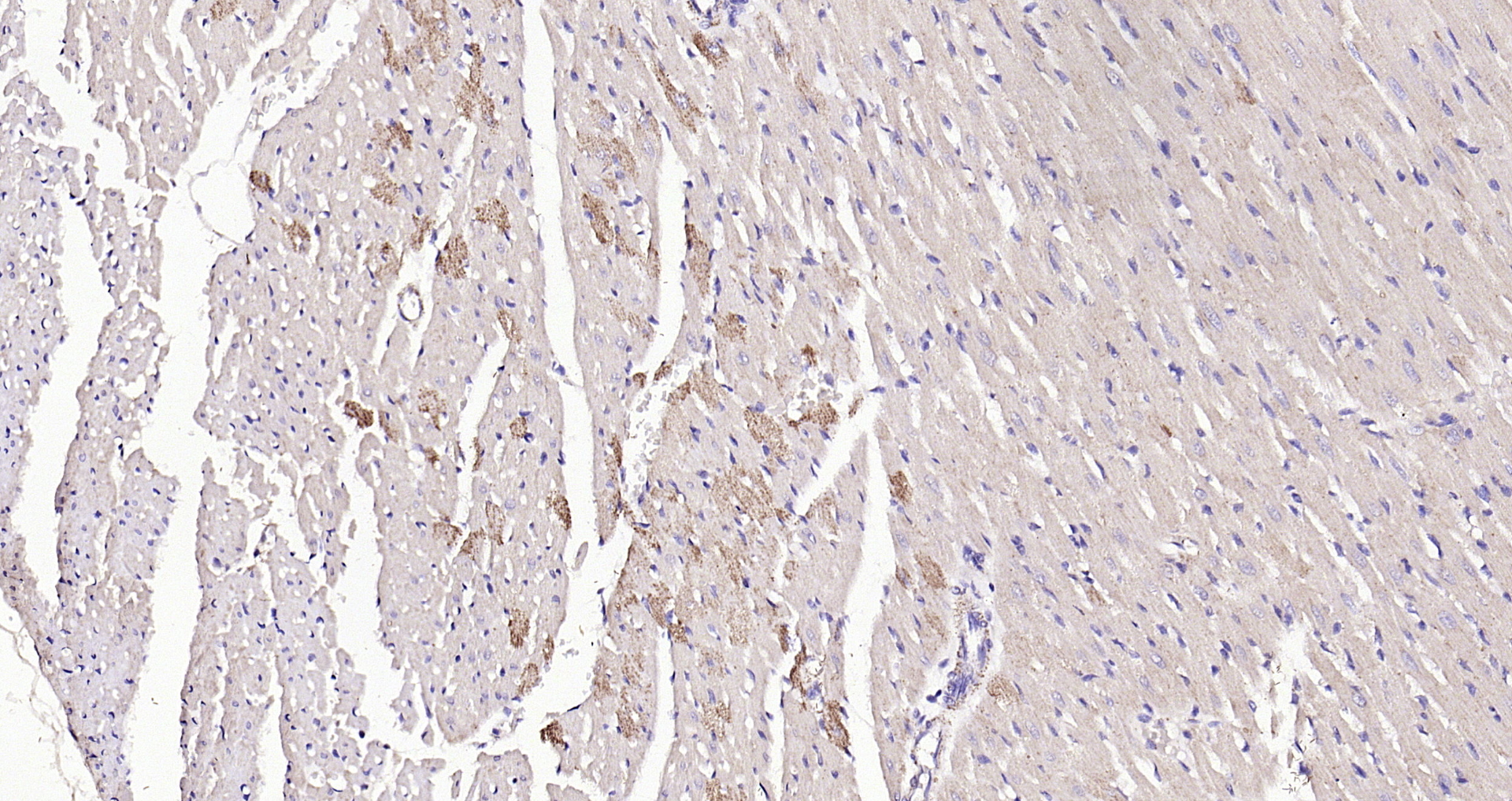 Paraformaldehyde-fixed, paraffin embedded (rat heart); Antigen retrieval by boiling in sodium citrate buffer (pH6.0) for 15min; Block endogenous peroxidase by 3% hydrogen peroxide for 20 minutes; Blocking buffer (normal goat serum) at 37°C for 30min; Antibody incubation with (Angiopoietin-1) Polyclonal Antibody, Unconjugated (bs-0800R) at 1:200 overnight at 4°C, followed by operating according to SP Kit(Rabbit) (sp-0023) instructionsand DAB staining.