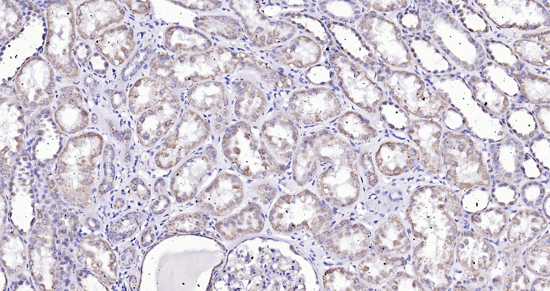 Paraformaldehyde-fixed, paraffin embedded (human kidney); Antigen retrieval by boiling in sodium citrate buffer (pH6.0) for 15min; Block endogenous peroxidase by 3% hydrogen peroxide for 20 minutes; Blocking buffer (normal goat serum) at 37°C for 30min; Antibody incubation with (Angiopoietin-1) Polyclonal Antibody, Unconjugated (bs-0800R) at 1:200 overnight at 4°C, followed by operating according to SP Kit(Rabbit) (sp-0023) instructionsand DAB staining.