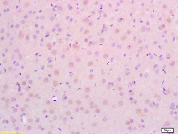 Formalin-fixed and rat brain tissue labeled with Anti-P14ARF Polyclonal Antibody, Unconjugated (bs-1174R) at 1:200 followed by conjugation to the secondary antibody and DAB staining