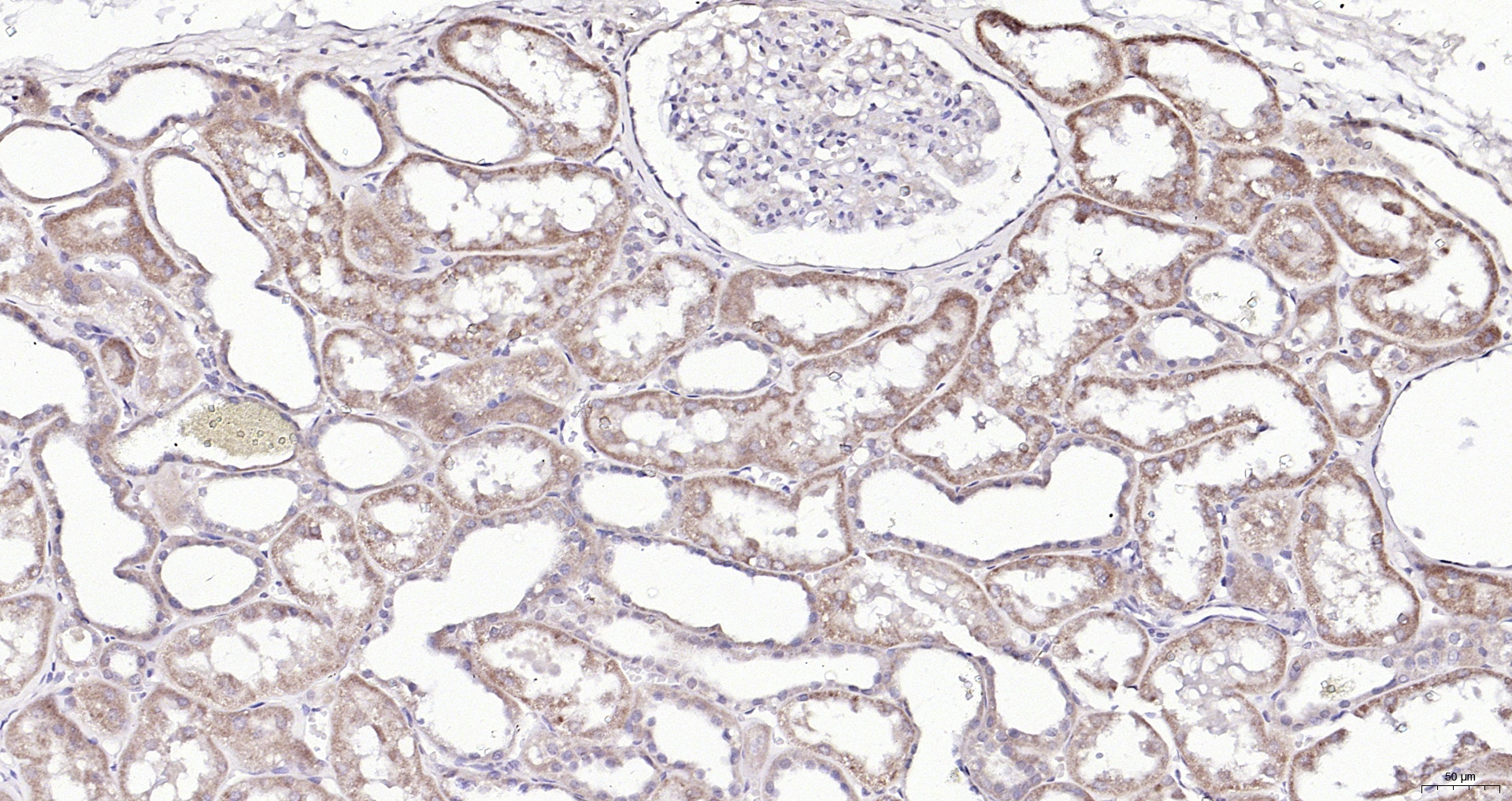 Paraformaldehyde-fixed, paraffin embedded (Human kidney); Antigen retrieval by boiling in sodium citrate buffer (pH6.0) for 15min; Block endogenous peroxidase by 3% hydrogen peroxide for 20 minutes; Blocking buffer (normal goat serum) at 37°C for 30min; Antibody incubation with (Sclerostin) Polyclonal Antibody, Unconjugated (bs-10200R) at 1:200 overnight at 4°C, followed by operating according to SP Kit(Rabbit) (sp-0023) instructionsand DAB staining.
